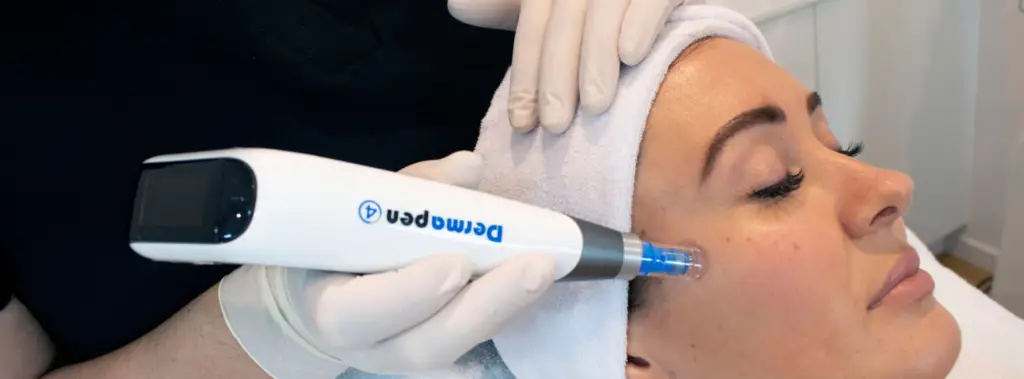 dermapen microneedling