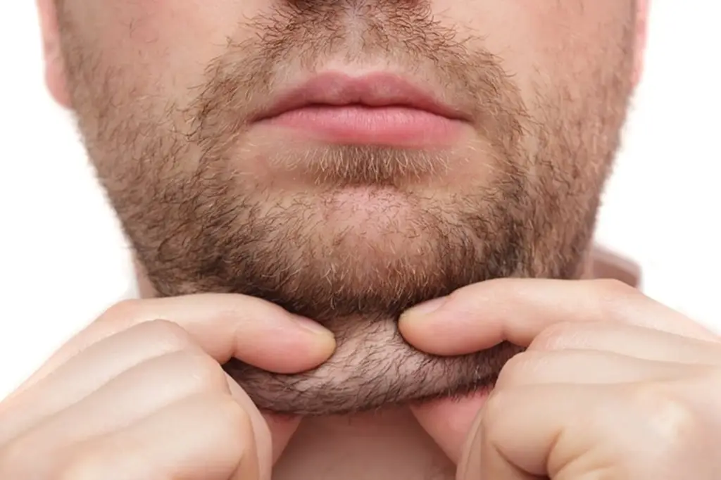 Double Chins