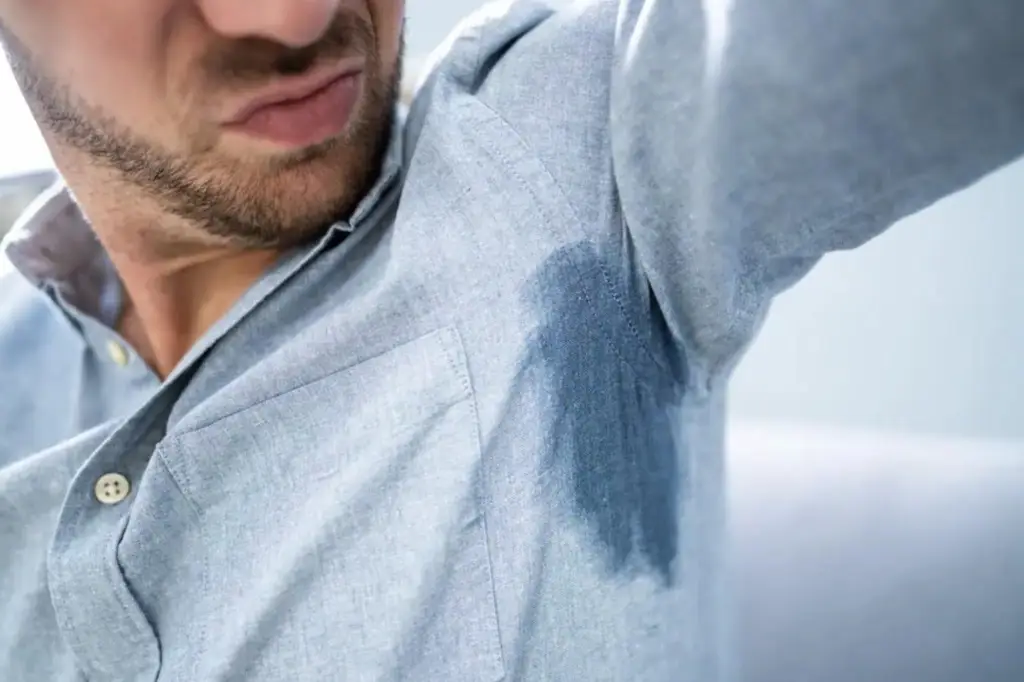 EXCESSIVE SWEATING (HYPERHIDROSIS)