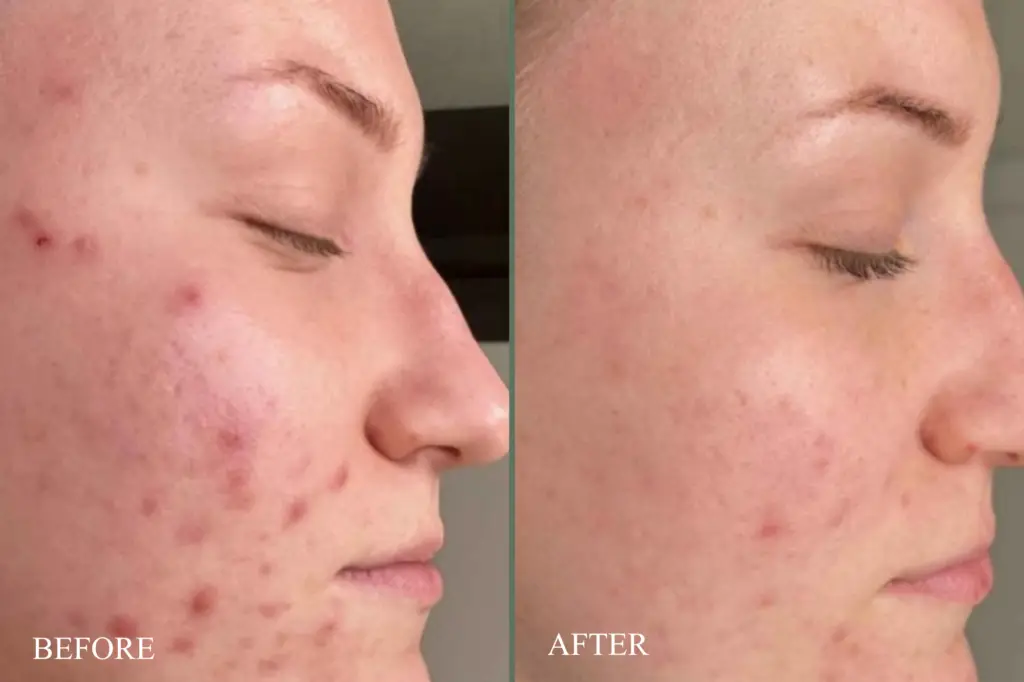 before after oxygen rx