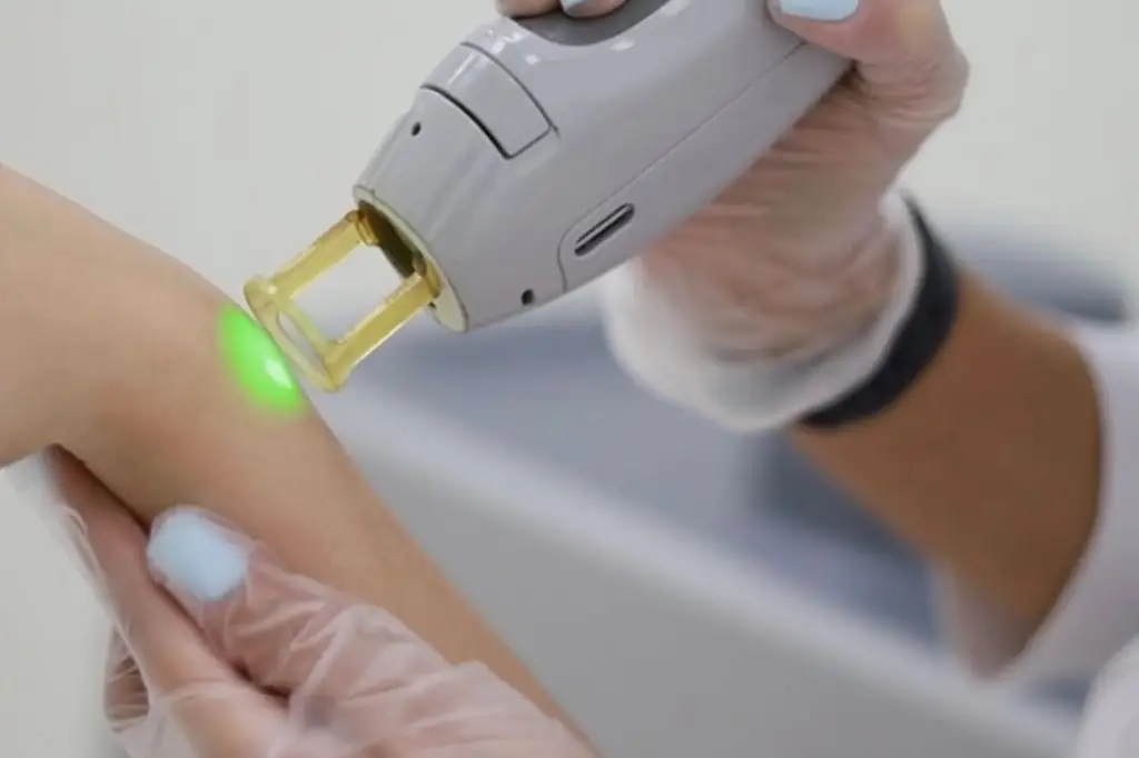 CANDELA gentle max pro