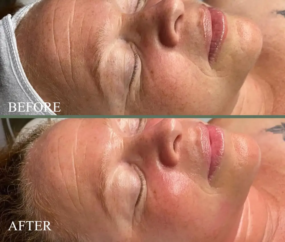 before after circadia oxygen rx