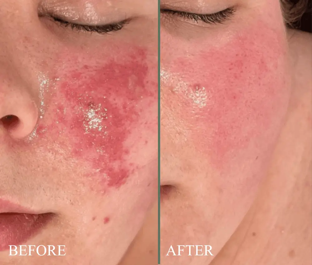 before after circadia oxygen