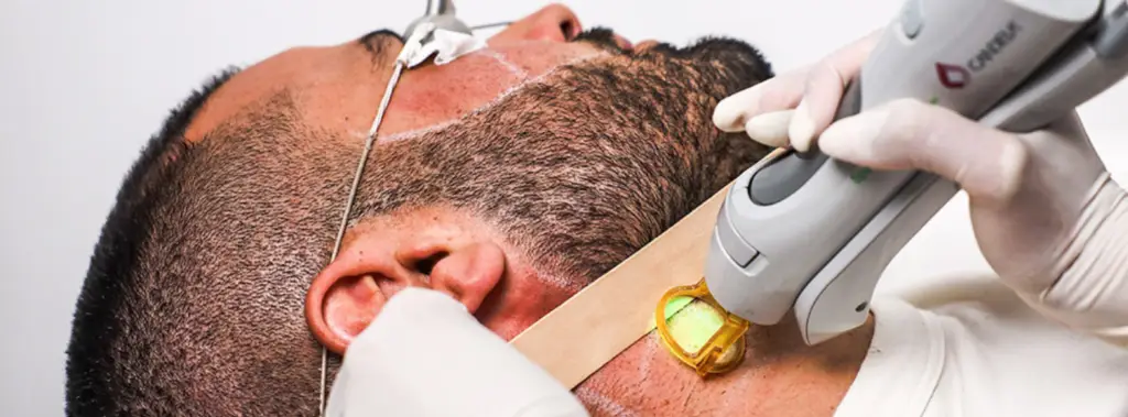 AGE SPOT & PIGMENT REMOVAL – CLINICAL LASER
